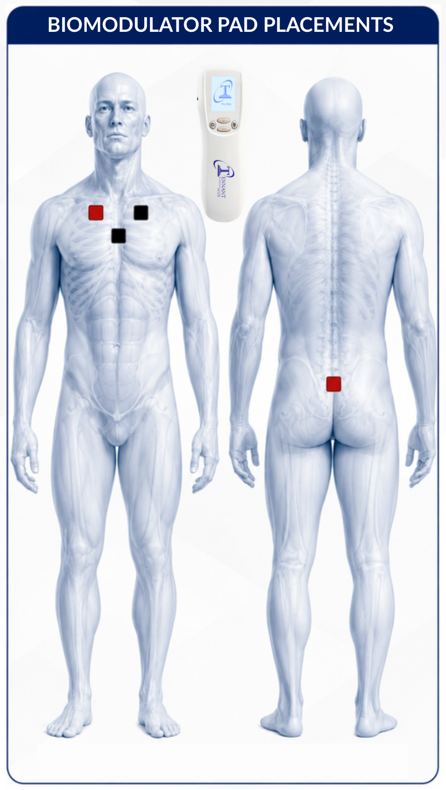 Front view: red marker at the body's right upper-chest point, black at the left upper-chest point, and black at the center sternum. Back view: red marker over the lower sacrum, just above the tailbone.